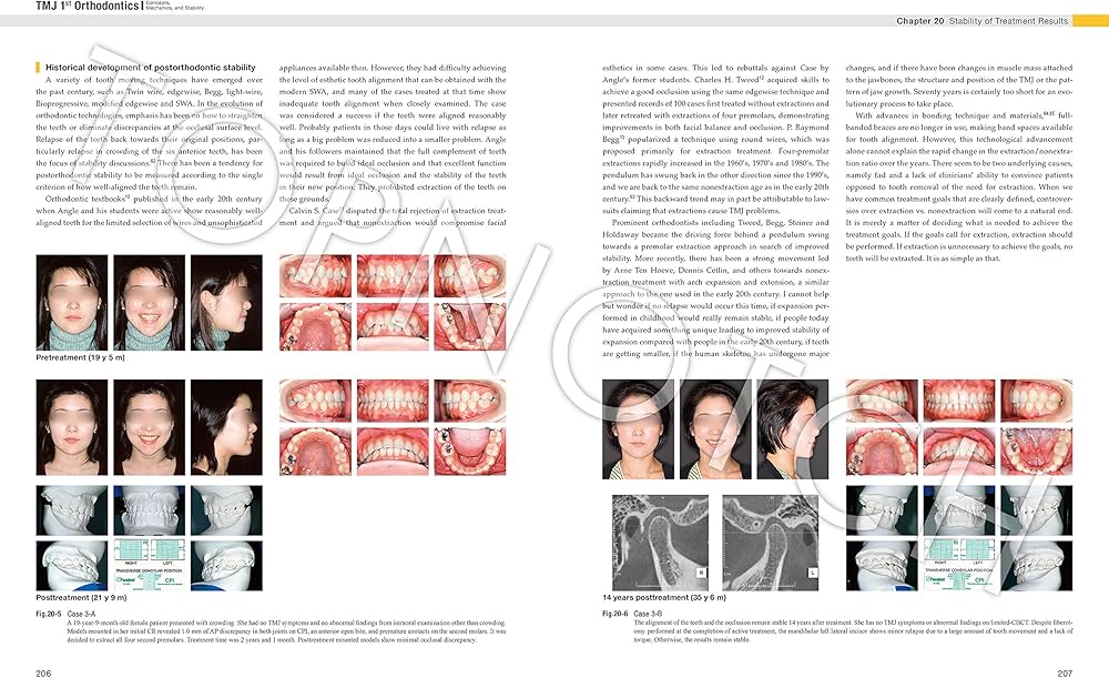 Amazon.com: TMJ 1st Orthodontics Concepts, Mechanics, and